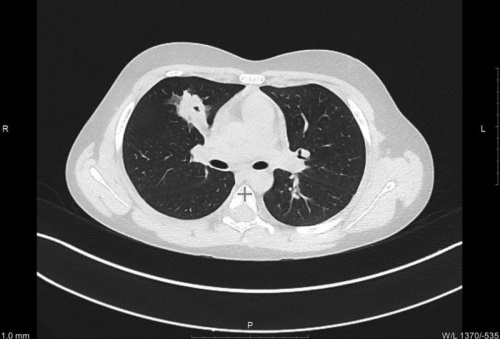 Изображение на обложке